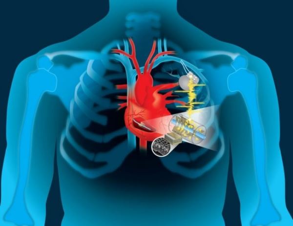 Вечный «мотор»: энергию сердца можно использовать для подзарядки кардиостимуляторов